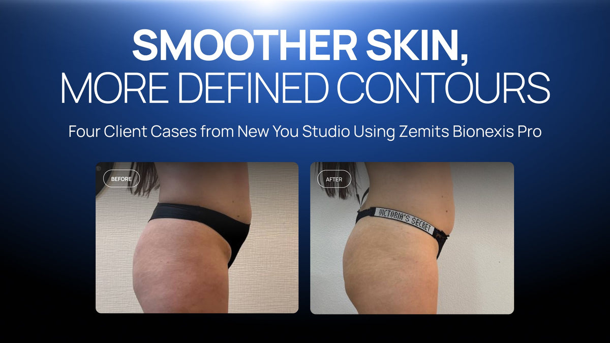 Four Client Cases from New You Studio Using Zemits Bionexis Pro