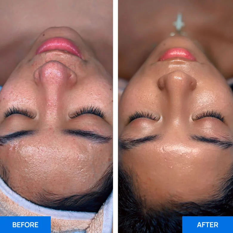 Before After Slide 4