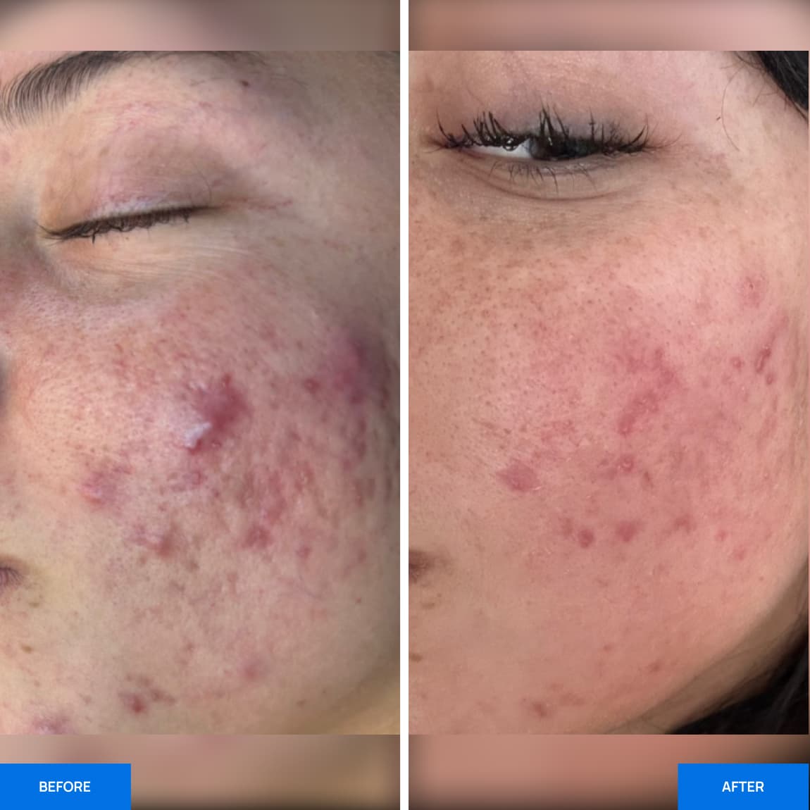 Before After Slide 1