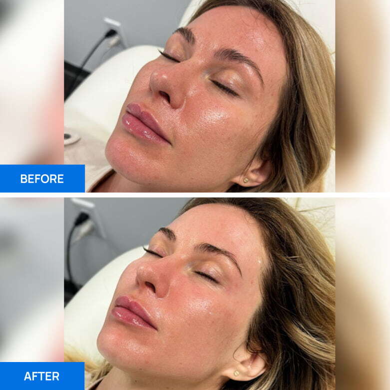 Before After Slide 2
