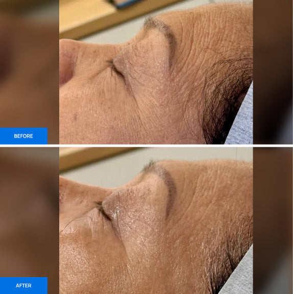 Before After Slide 1
