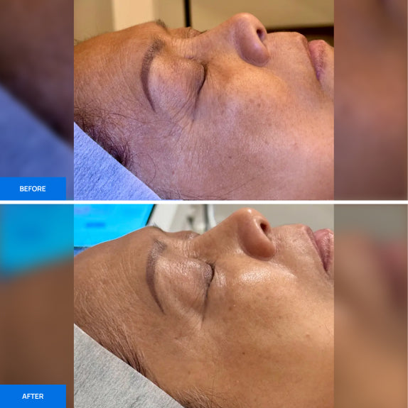 Before After Slide 3