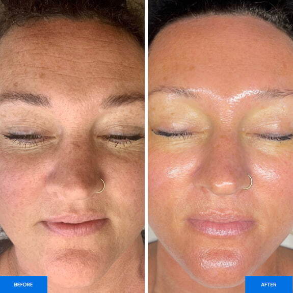 Before After Slide 3