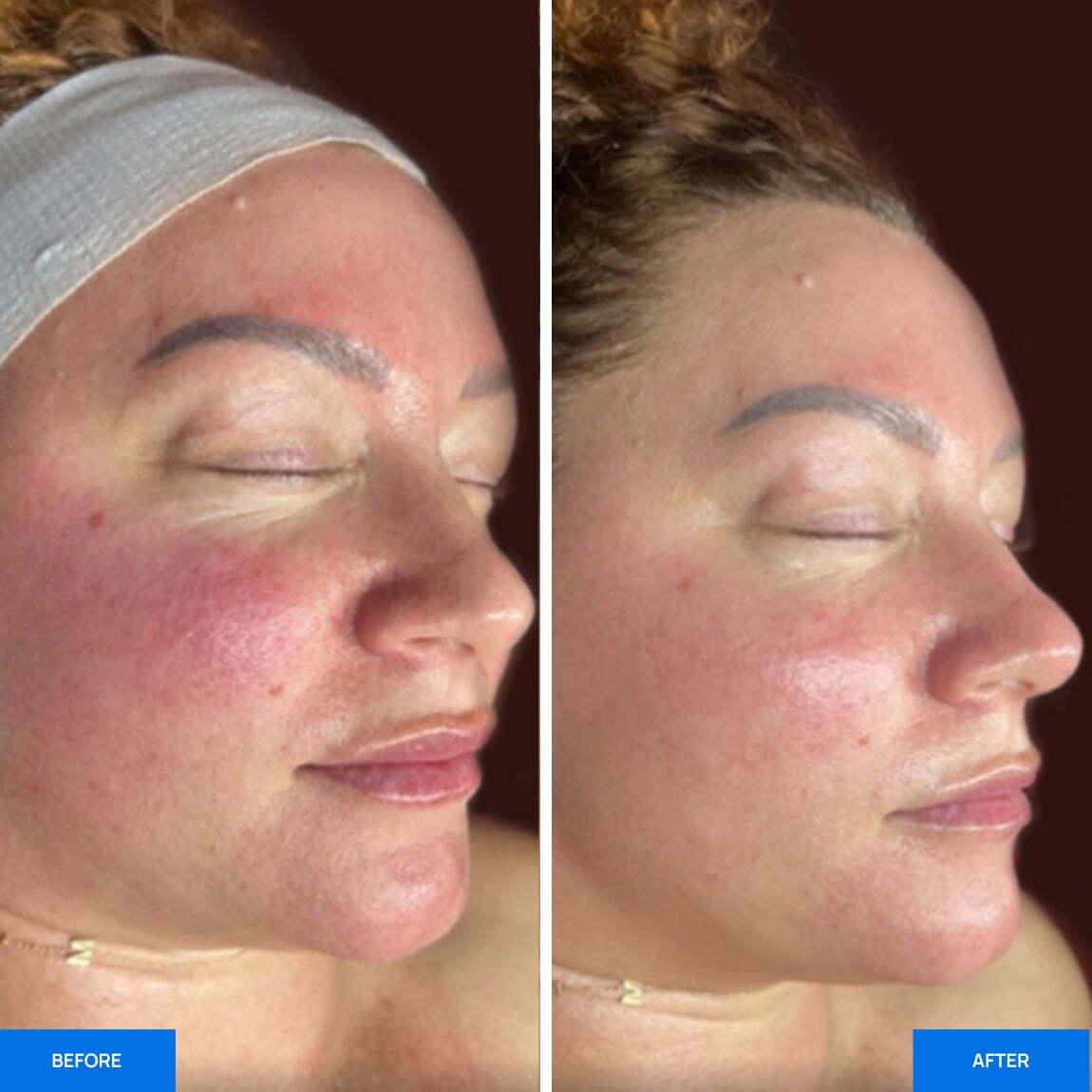 Before After Slide 2