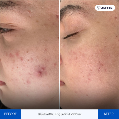 Before After Slide 1