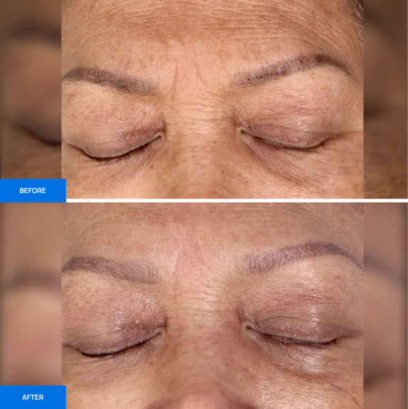 Before After Slide 2