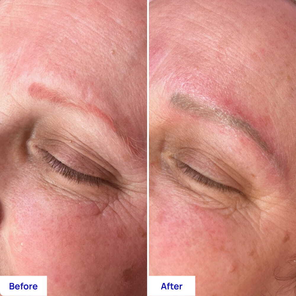 Before After Slide 2