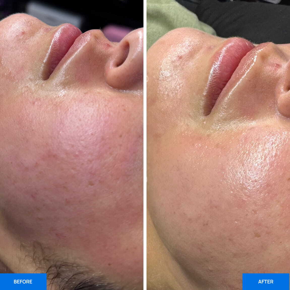 Before After Slide 3
