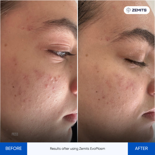 Before After Slide 2