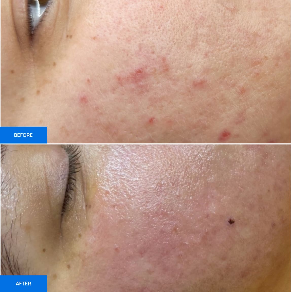 Before After Slide 3