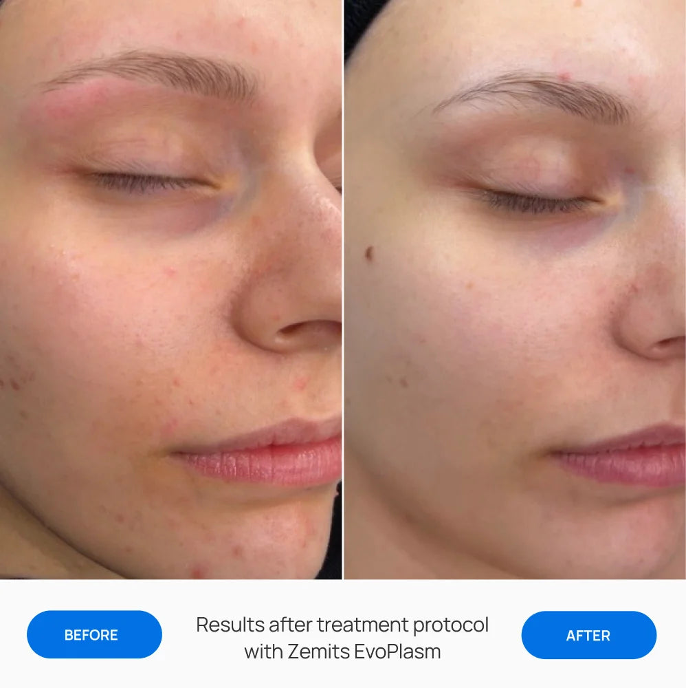 Before After Slide 1