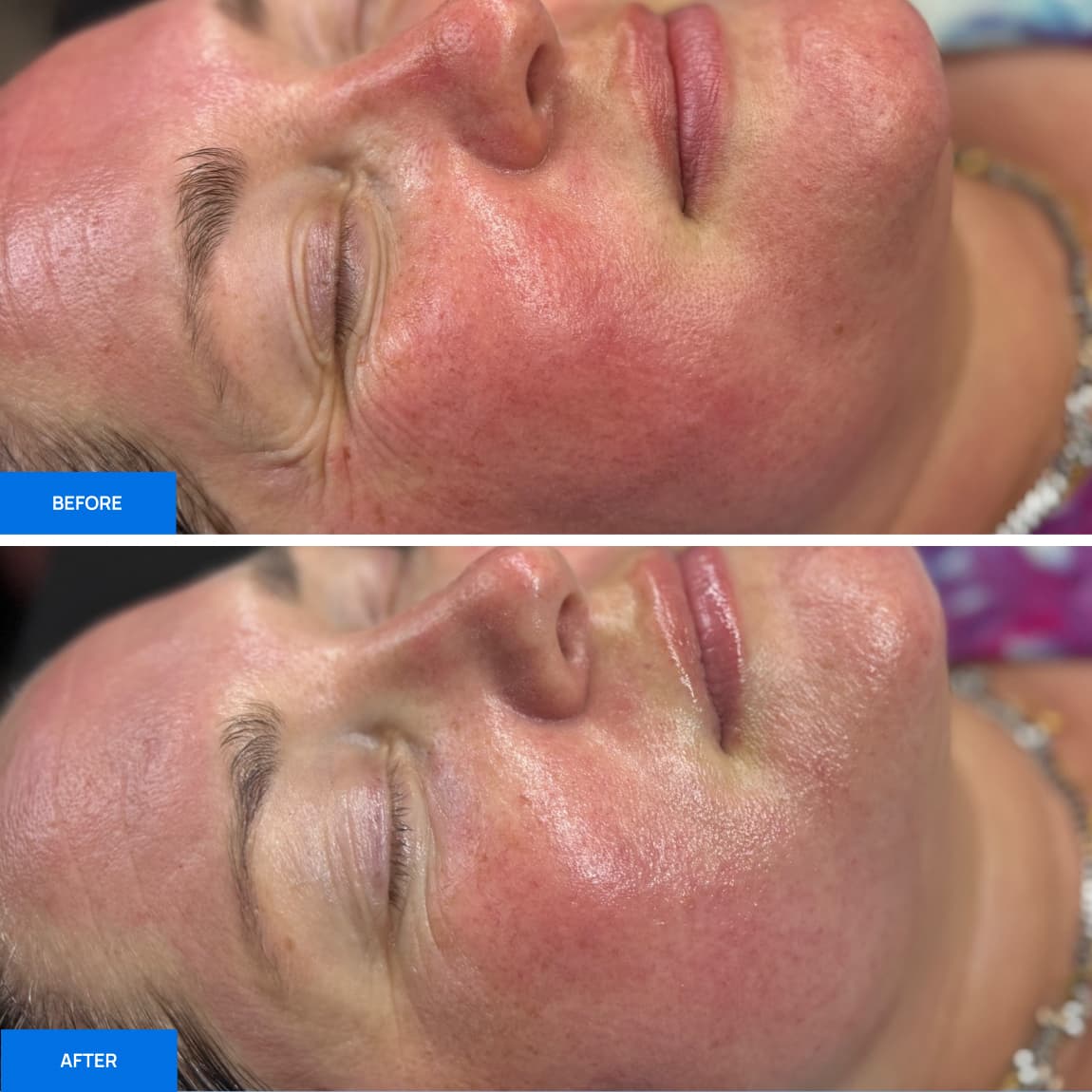Before After Slide 1