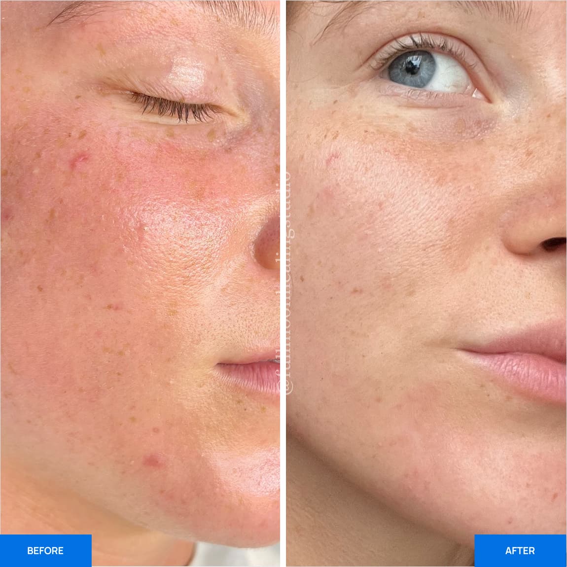 Before After Slide 4