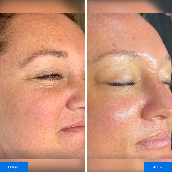 Before After Slide 2