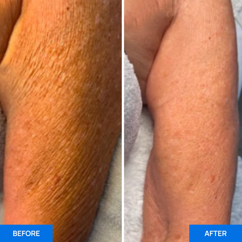 Before After Slide 2