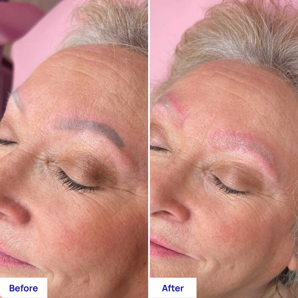 Before After Slide 4