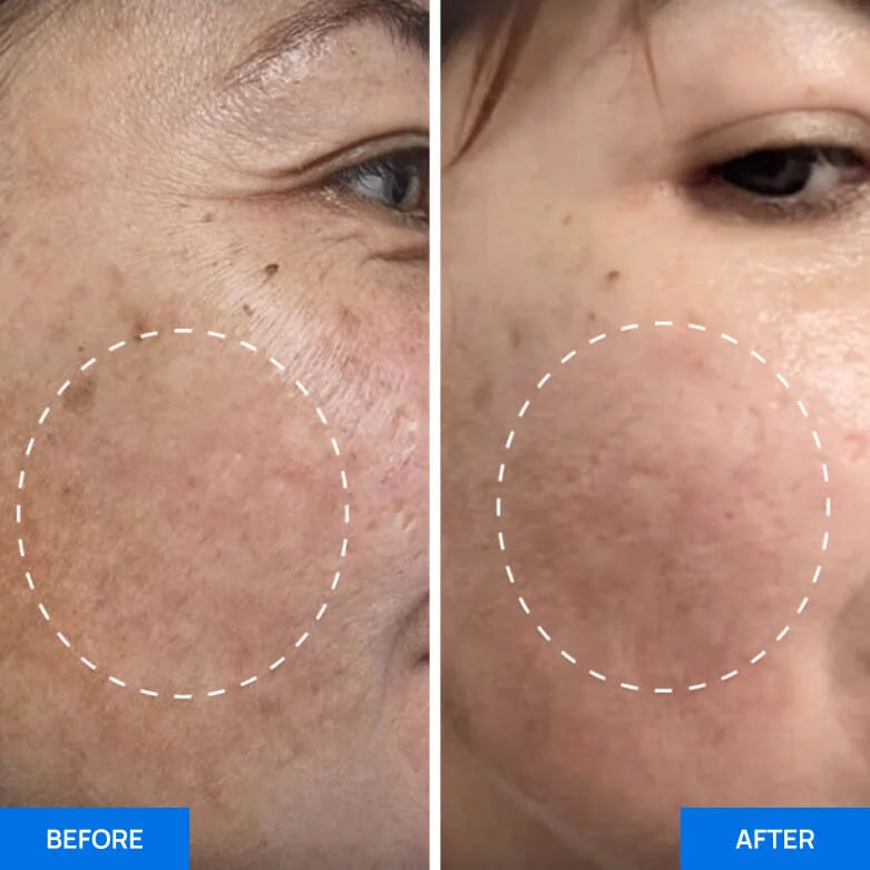 Before After Slide 3