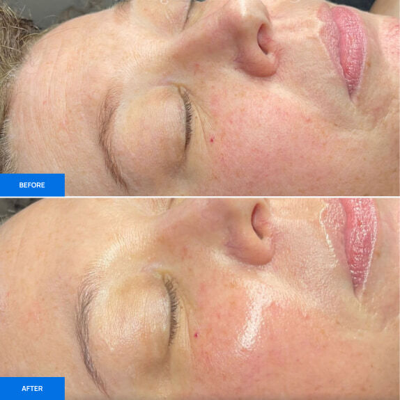Before After Slide 4