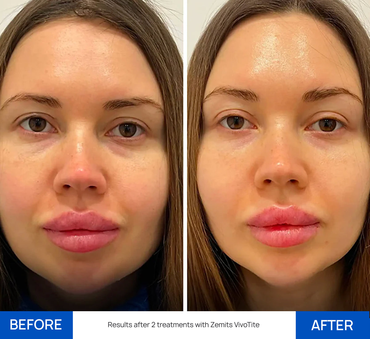 Before After Slide 2