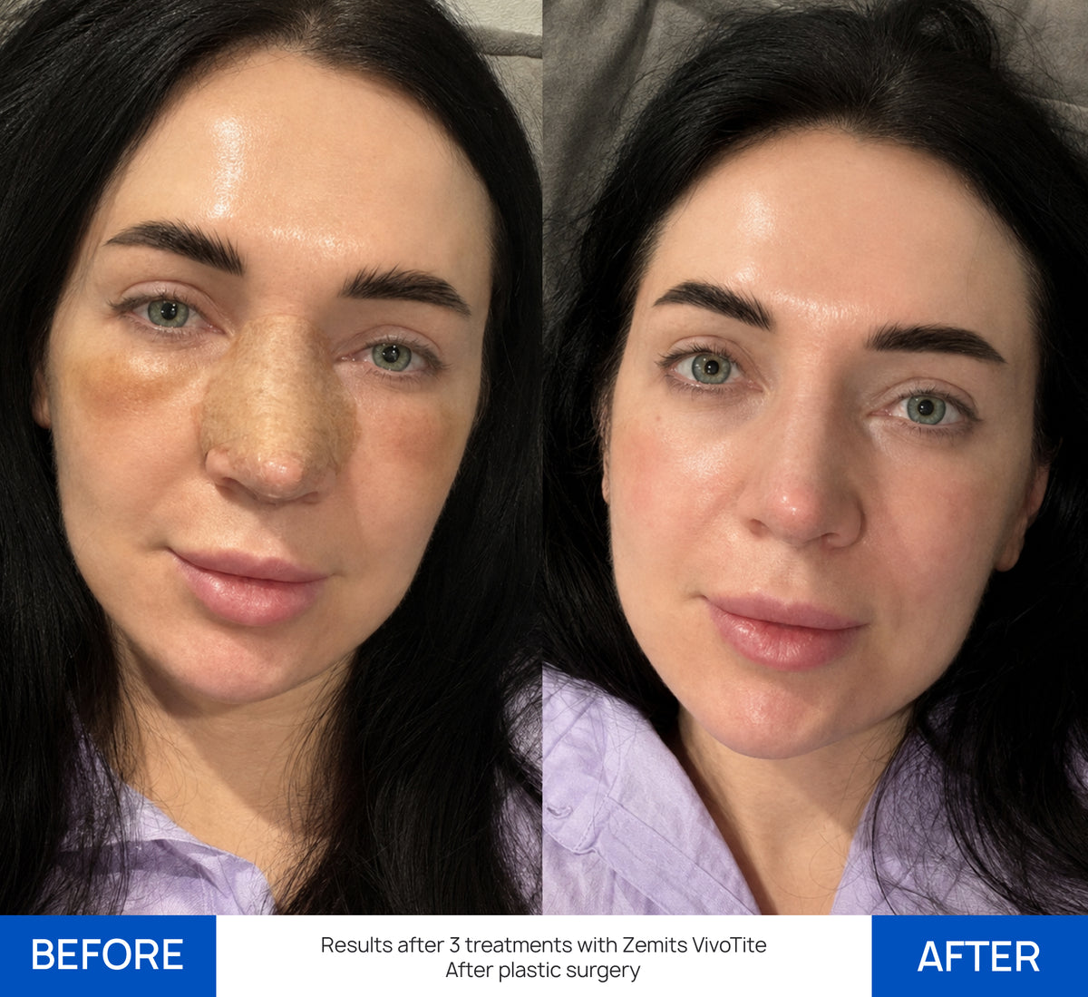Before After Slide 3