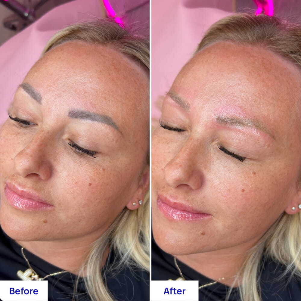 Before After Slide 5