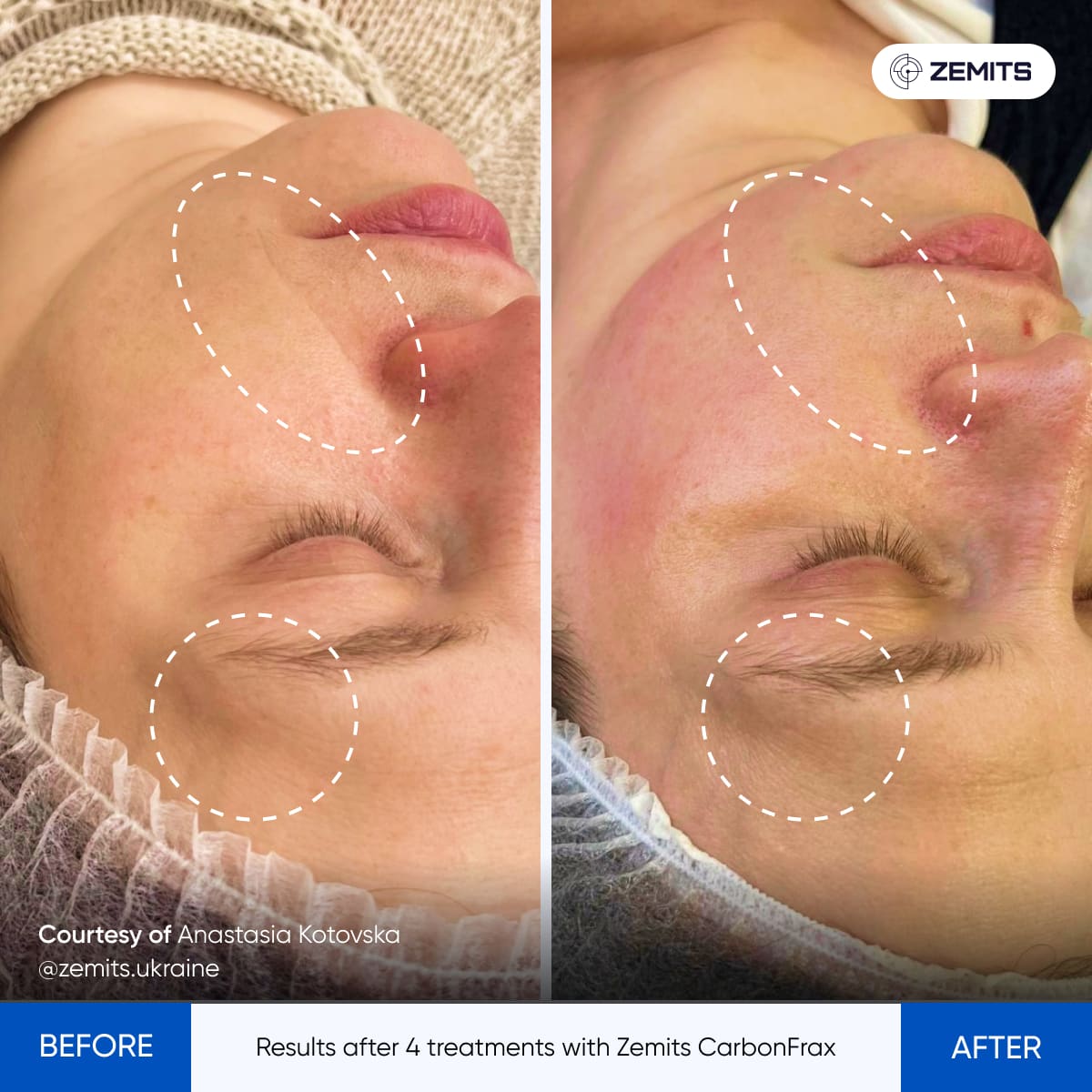 Before After Slide 5
