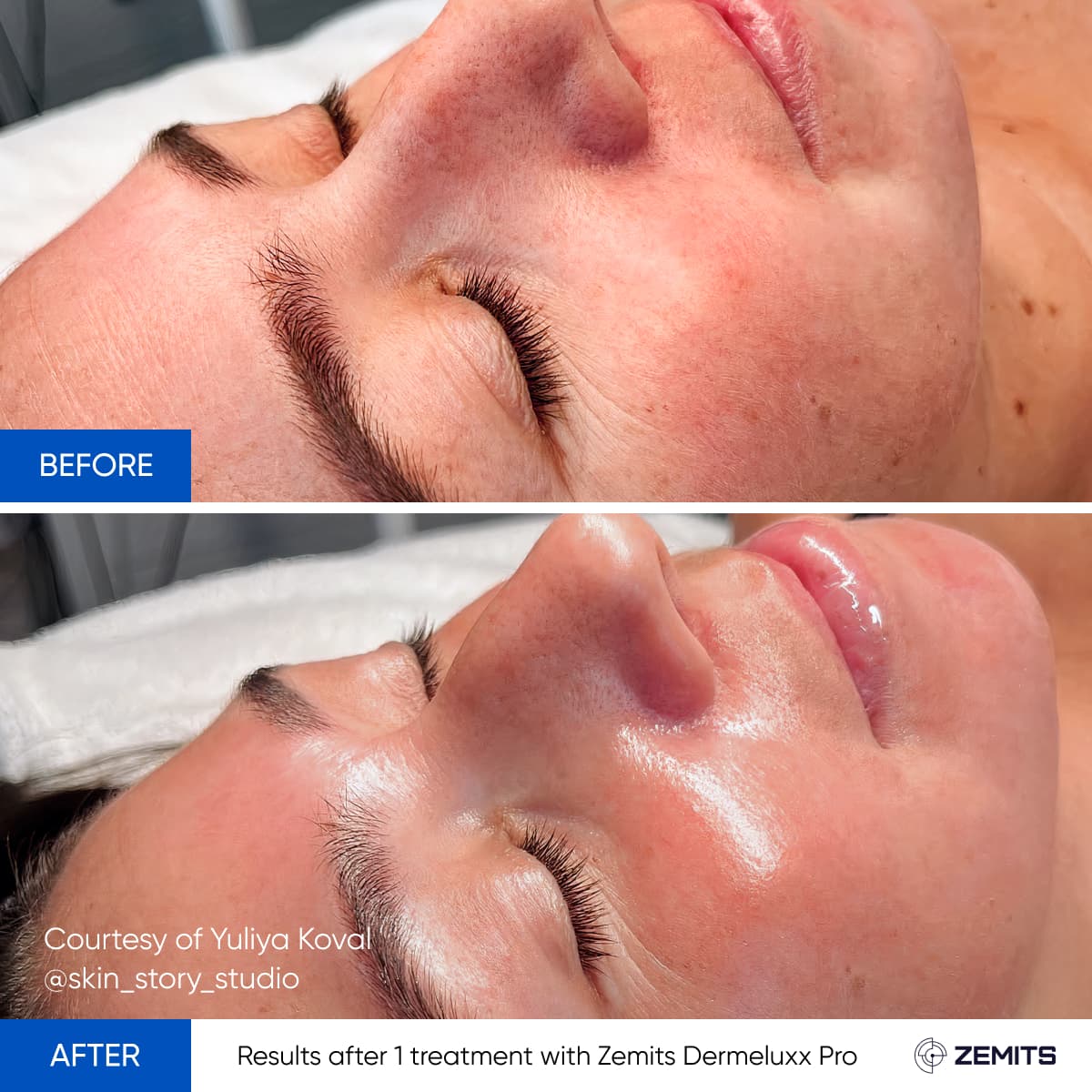 Before After Slide 18