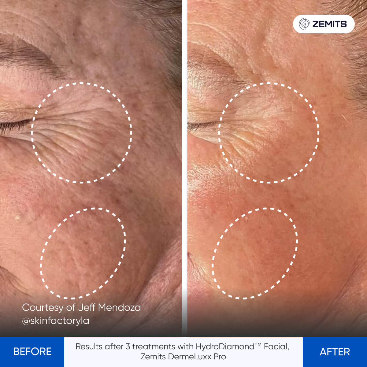 Before After Slide 3