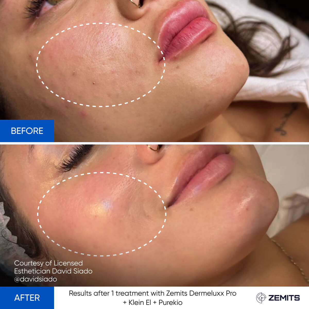 Before After Slide 14