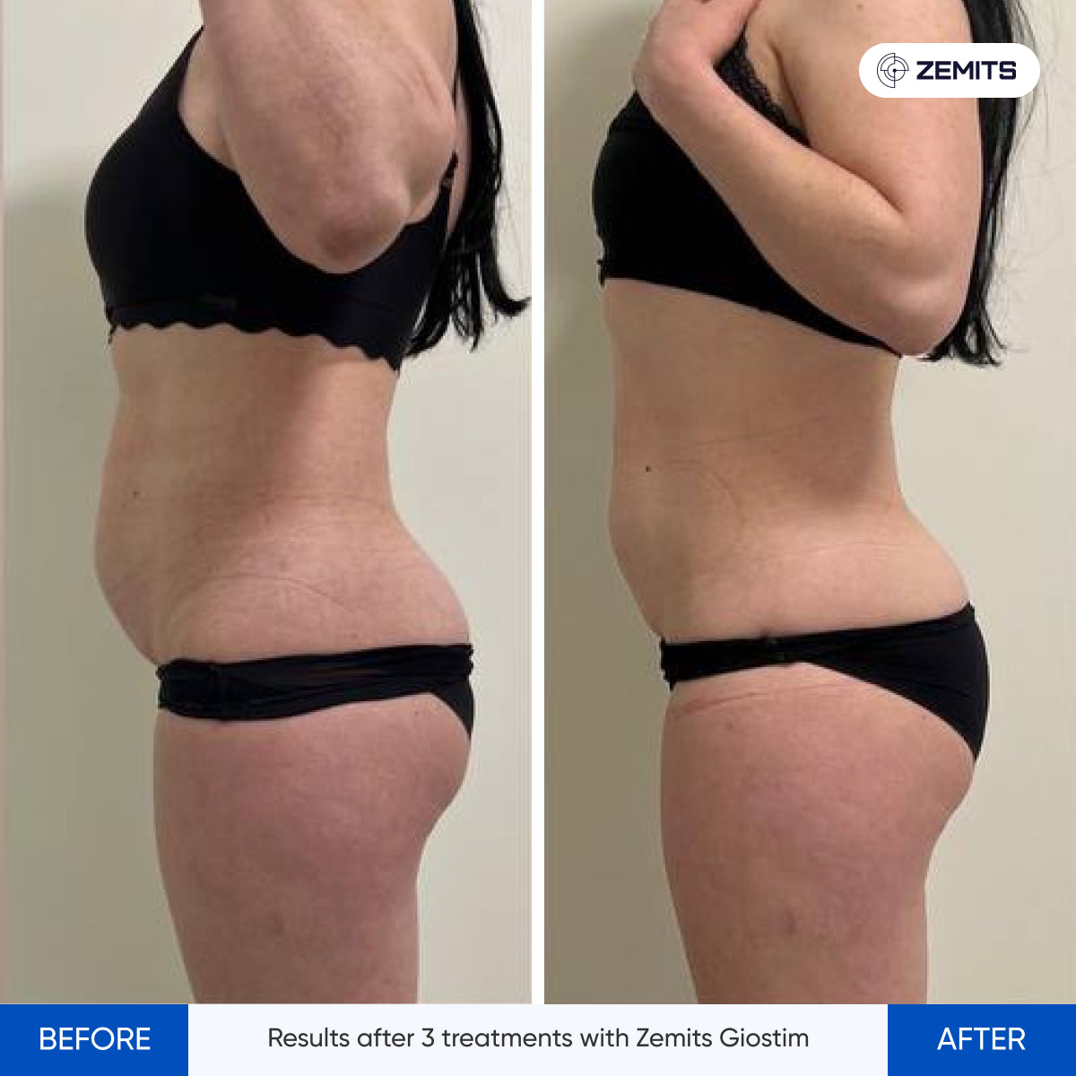 Before After Slide 12