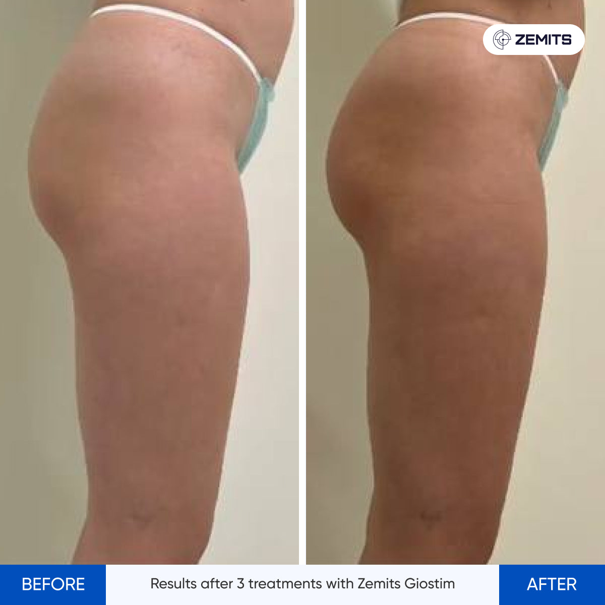 Before After Slide 13