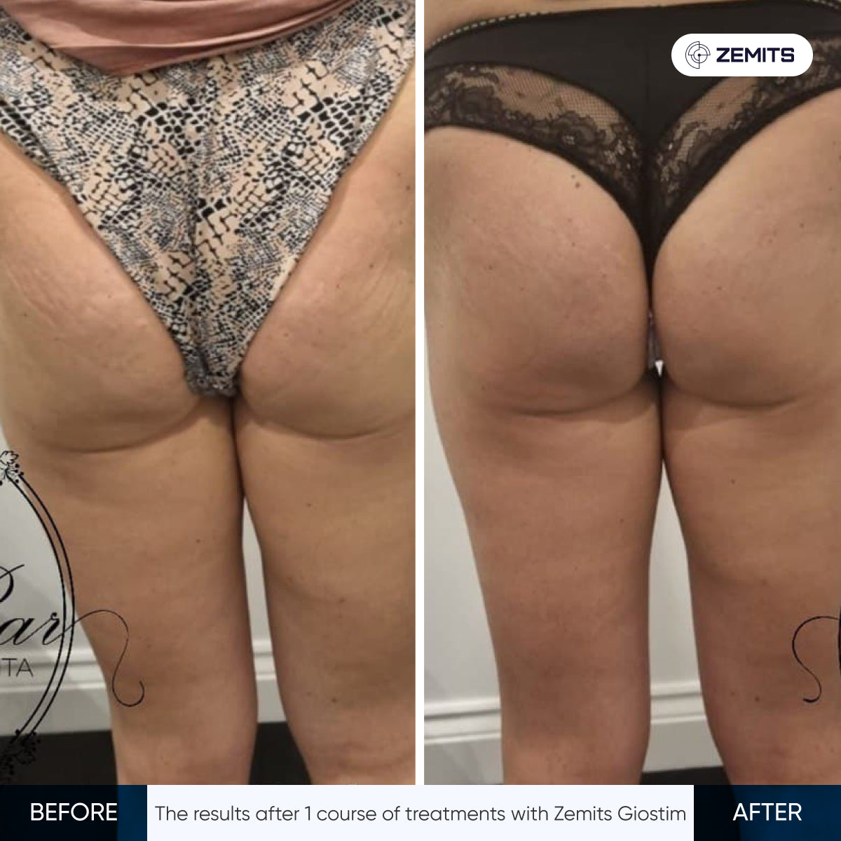 Before After Slide 14