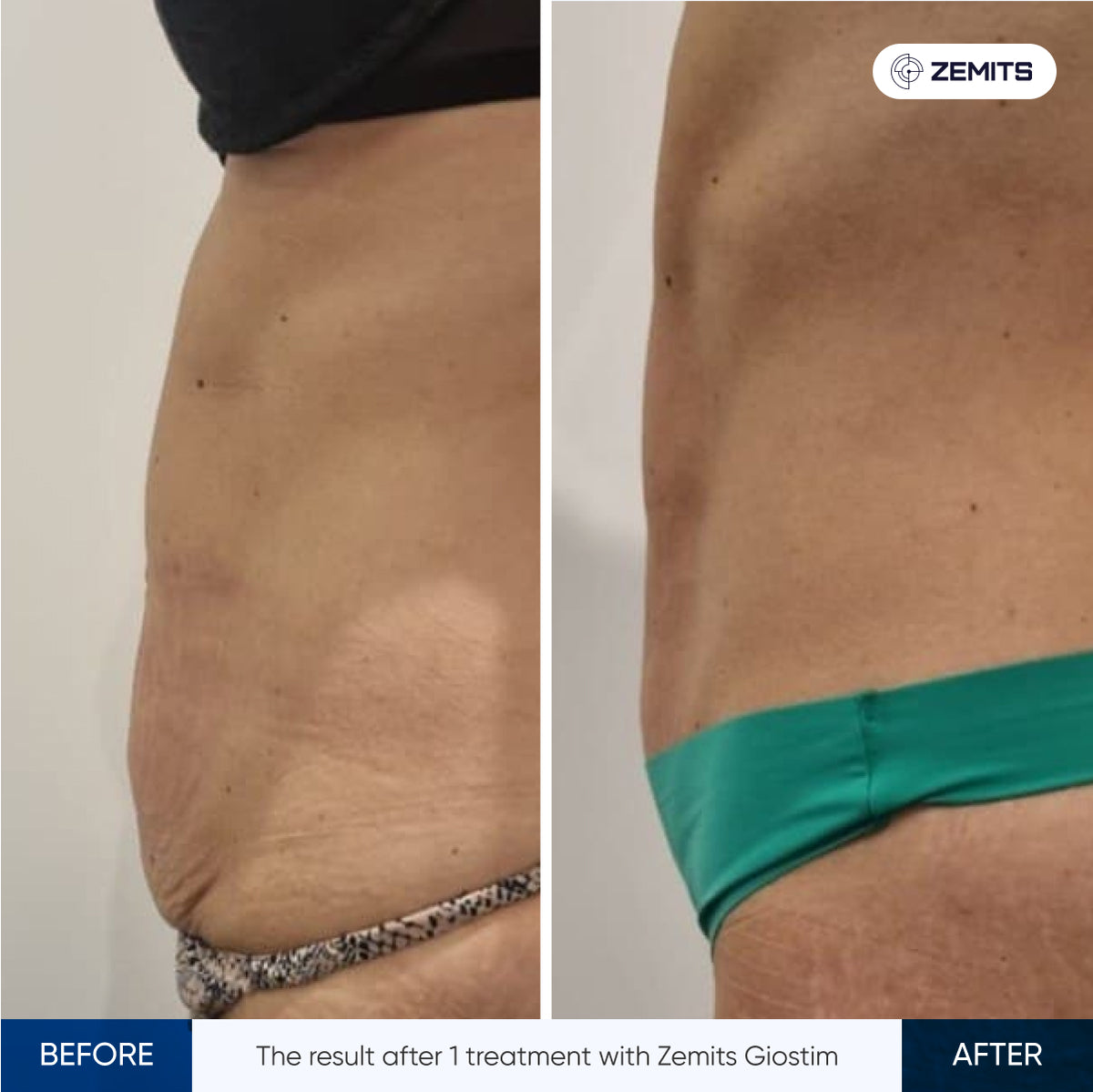 Before After Slide 15
