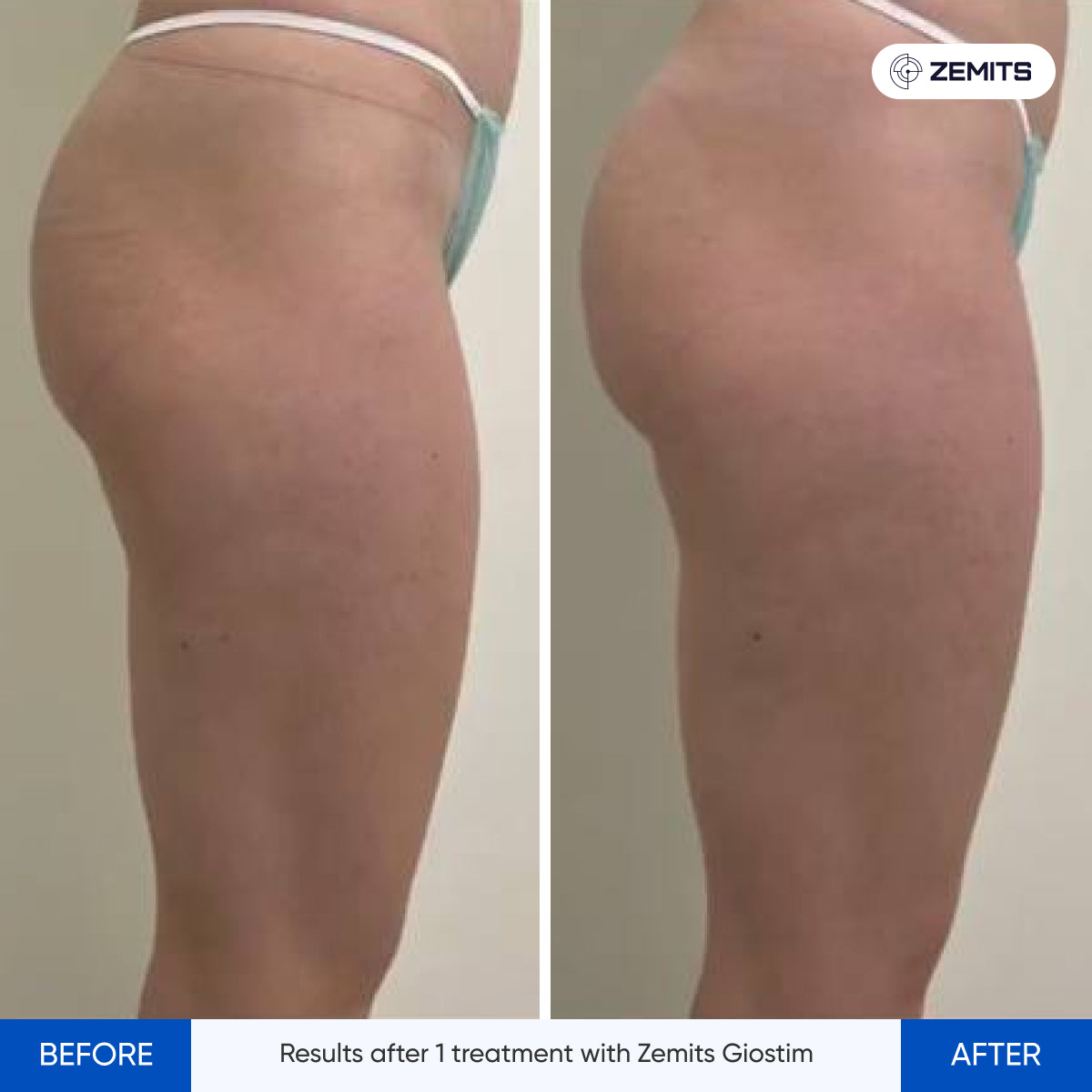 Before After Slide 16