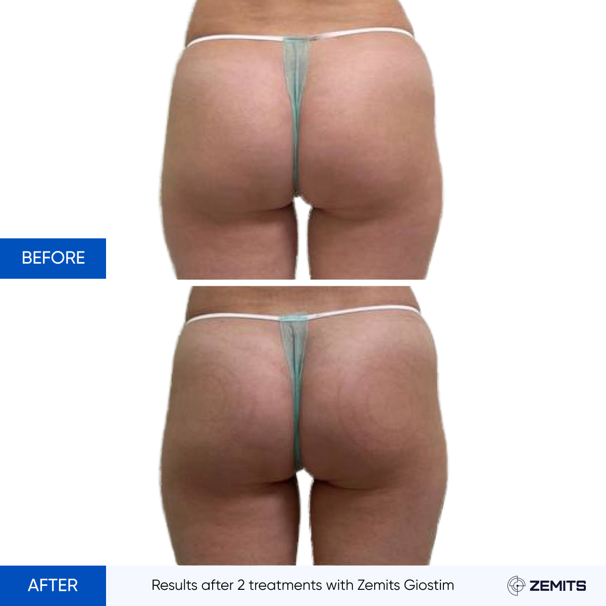 Before After Slide 17