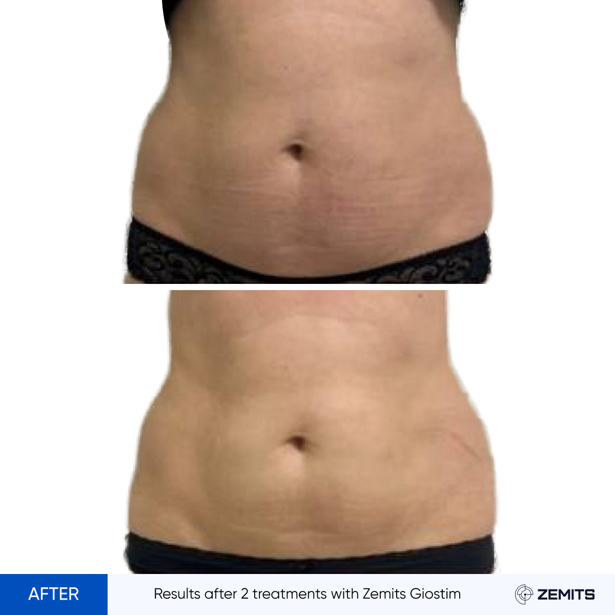 Before After Slide 18