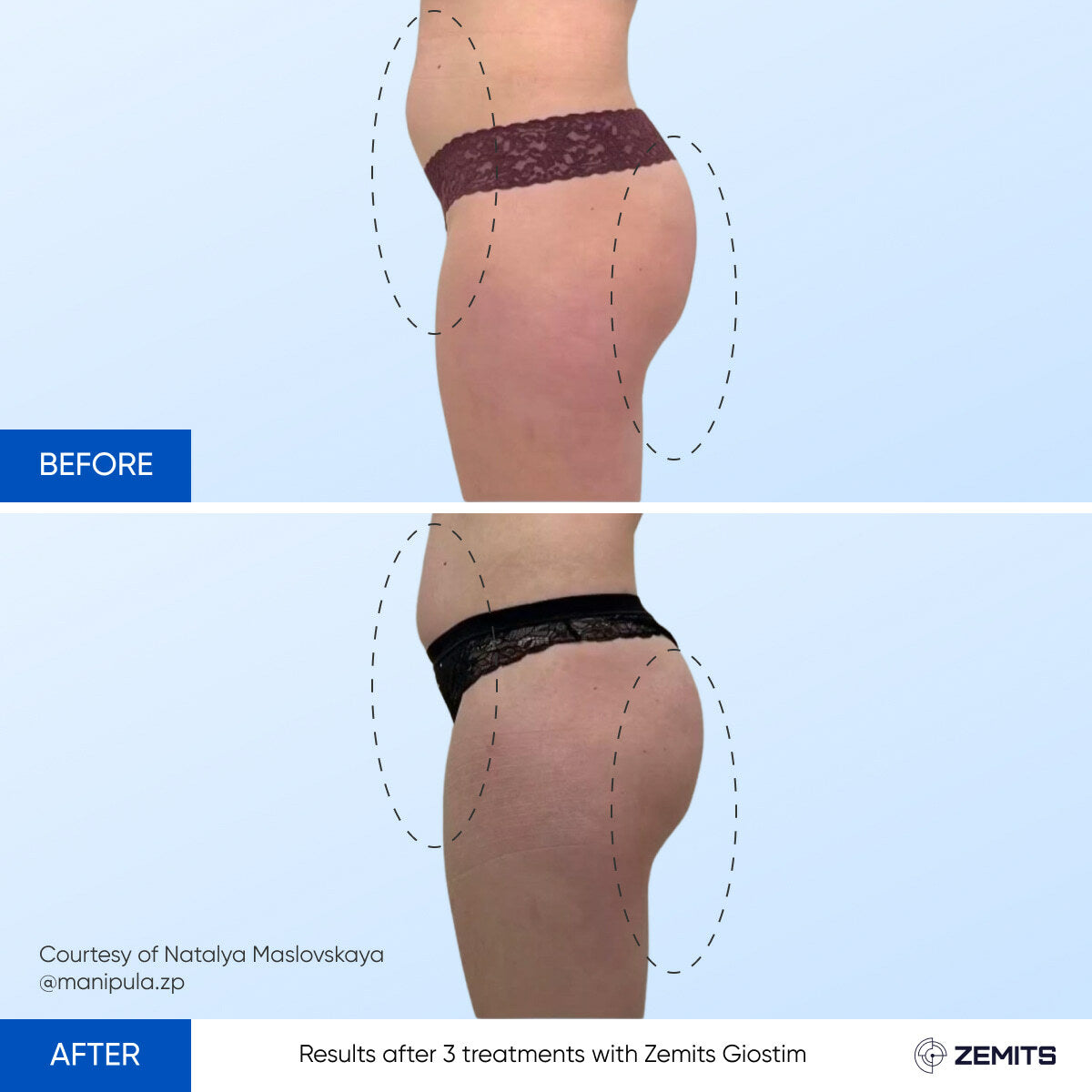 Before After Slide 4
