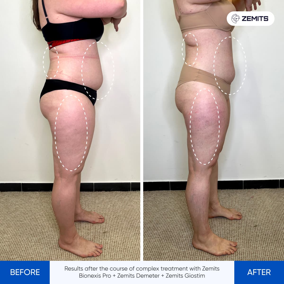 Before After Slide 5