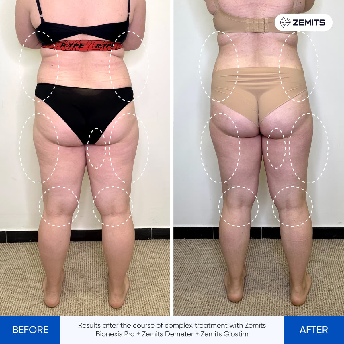 Before After Slide 6