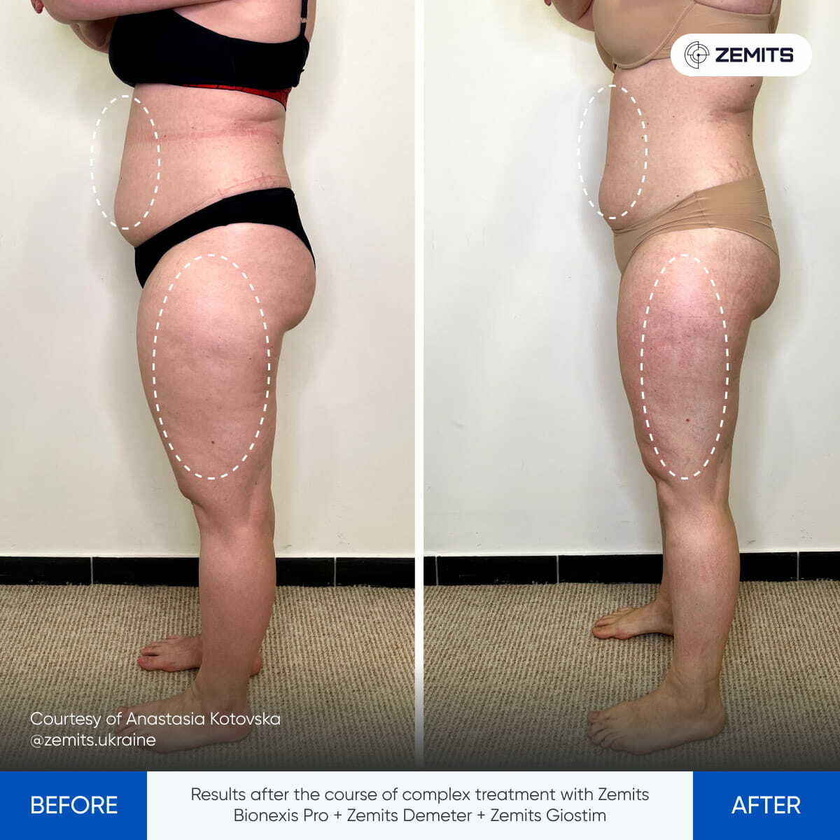 Before After Slide 7
