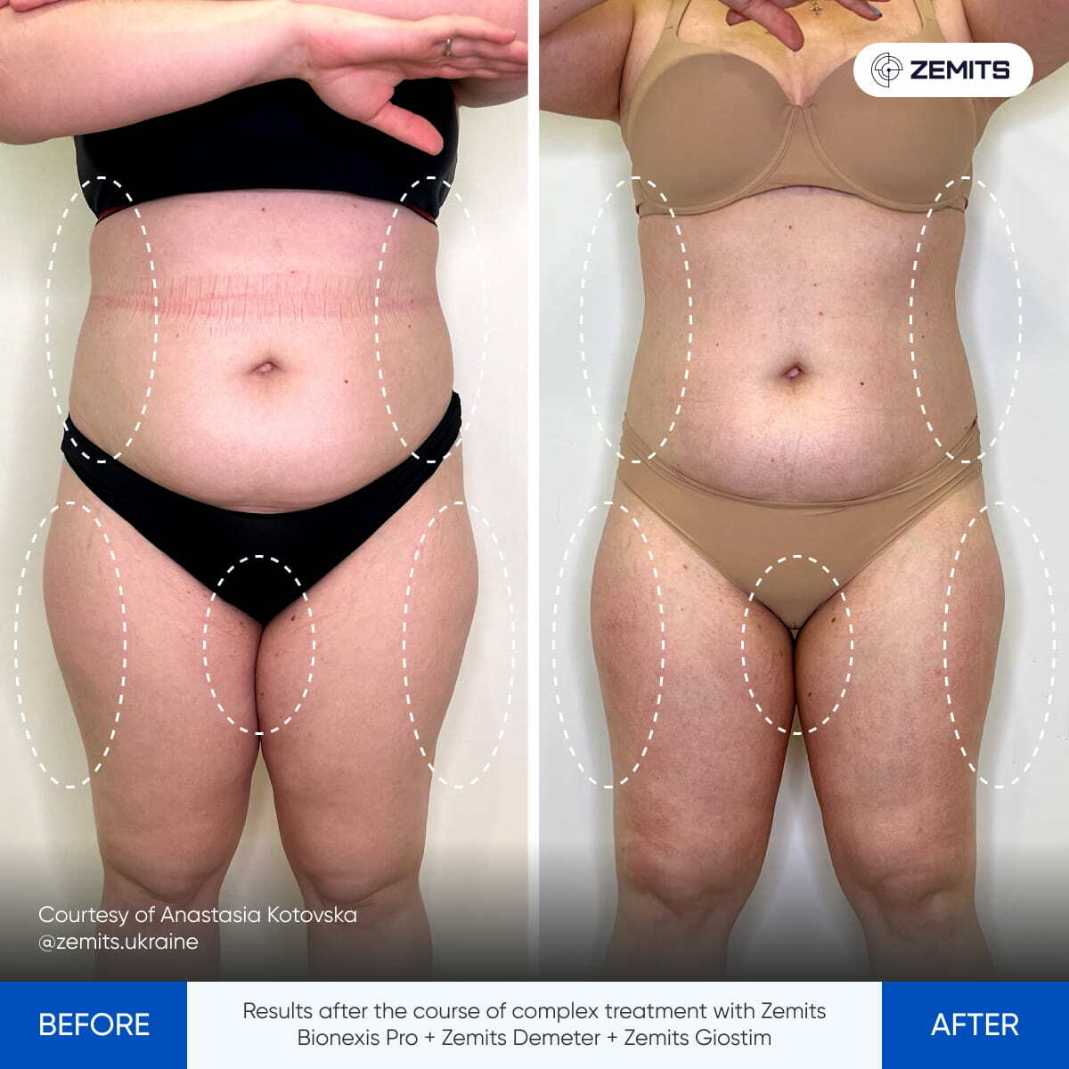 Before After Slide 8