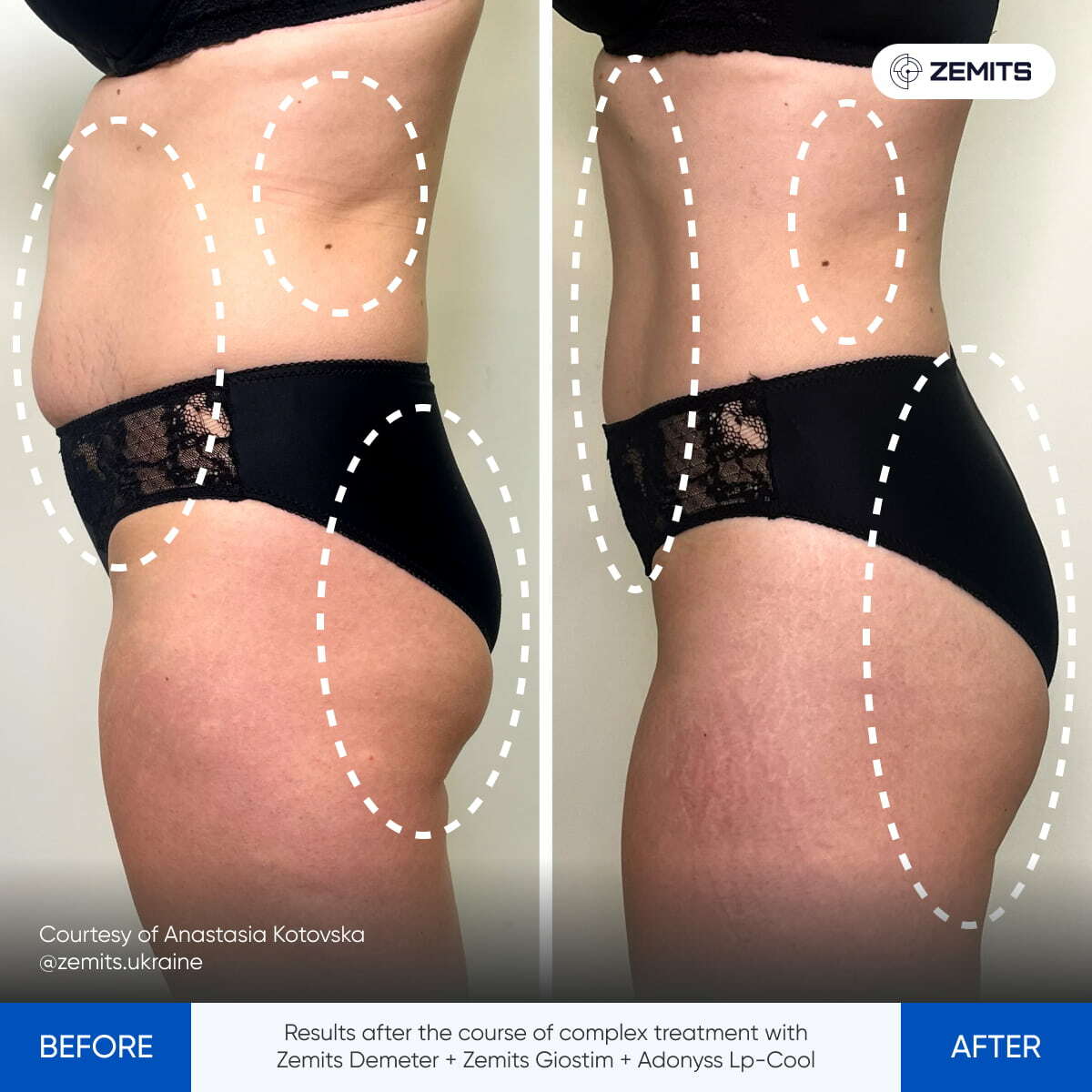 Before After Slide 9