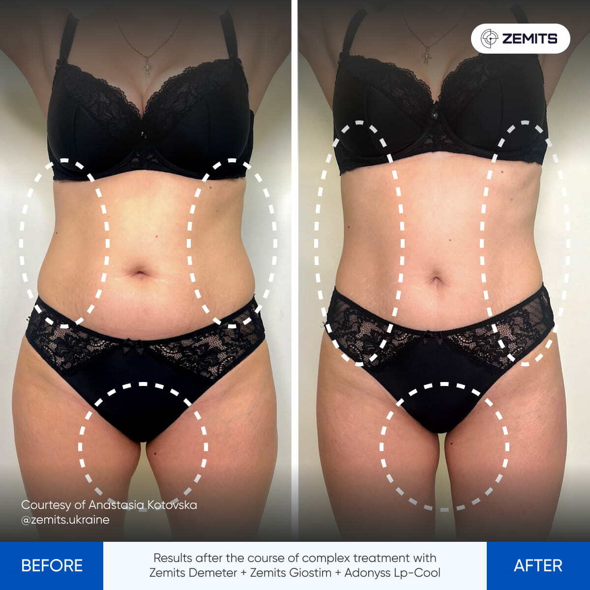 Before After Slide 10