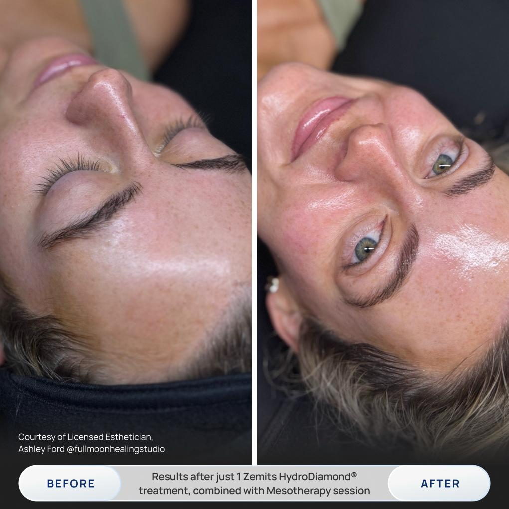 Before After Slide 2