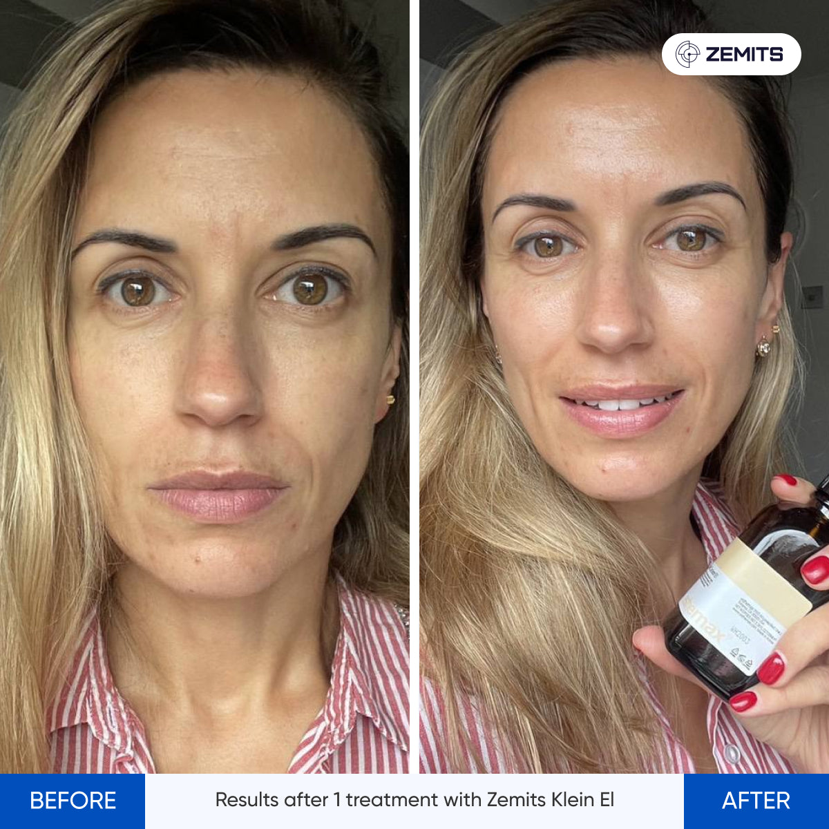 Before After Slide 6