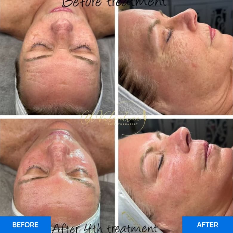 Before After Slide 7
