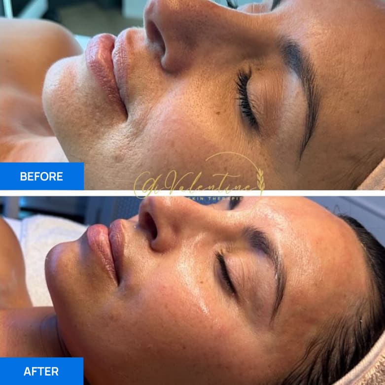 Before After Slide 1