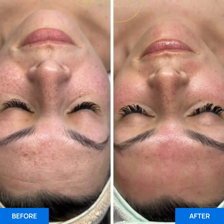 Before After Slide 2