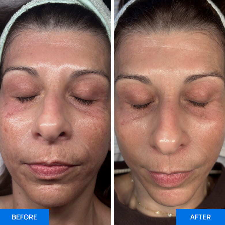 Before After Slide 6