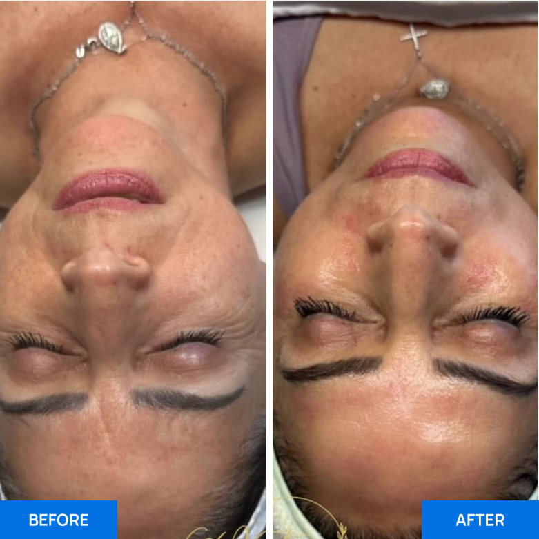 Before After Slide 4